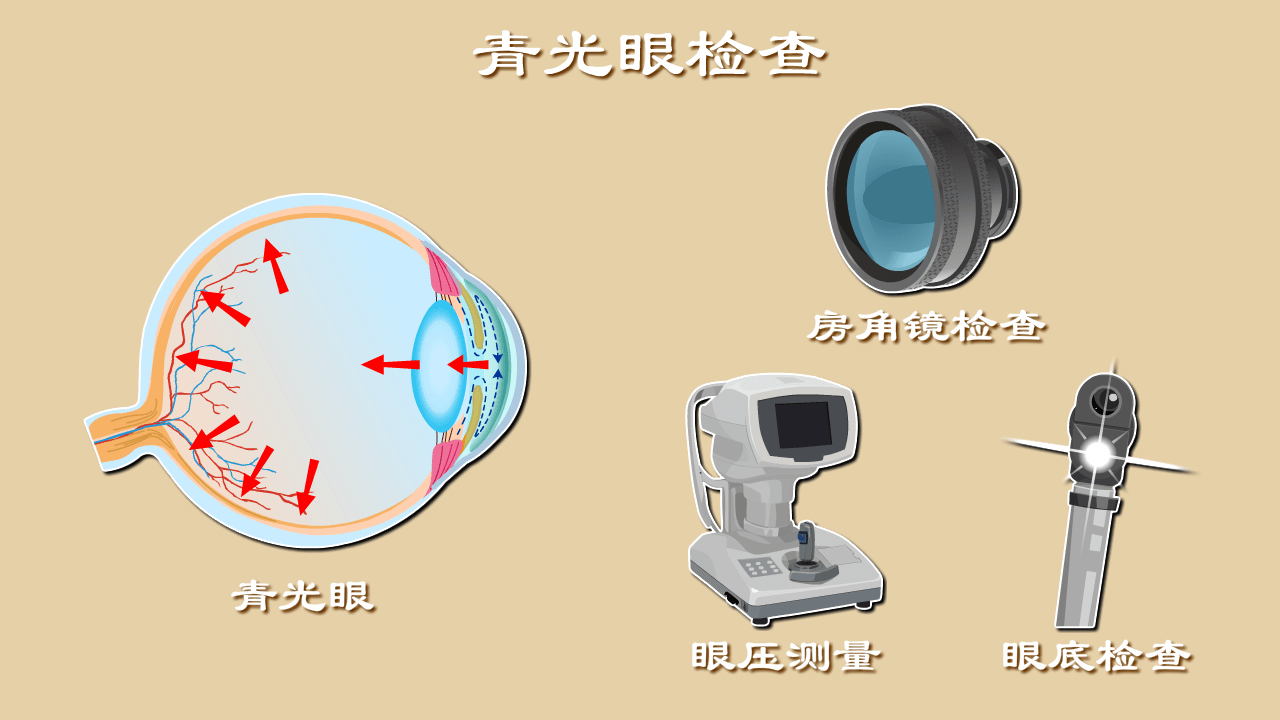 青光眼的最新消息，研究、治療與預(yù)防的新進展，青光眼研究、治療與預(yù)防的最新進展報道速遞